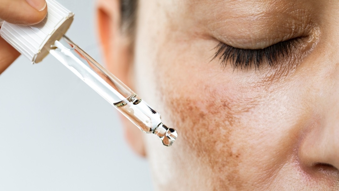 Dermatologist in Beeramguda