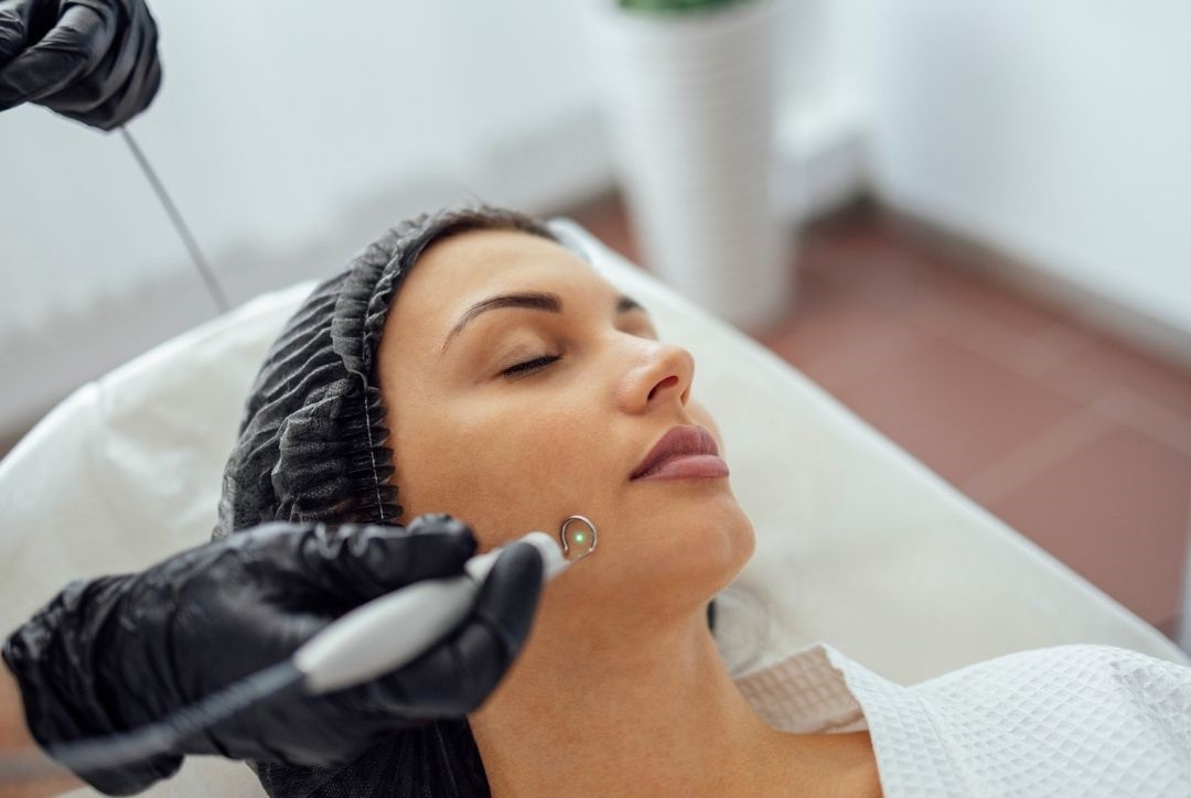 Pigmentation treatment in Beeramguda 